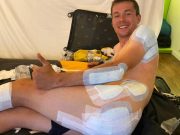 Heridas de Primoz Roglic Tour de Francia