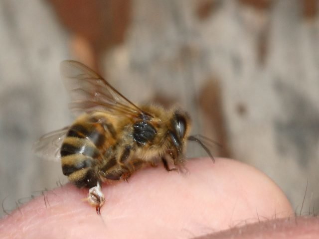  aguijoneado por una abeja