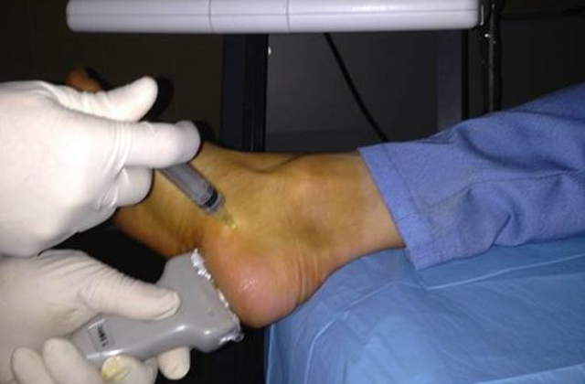 Plantillas para evitar lesiones graves en el pie